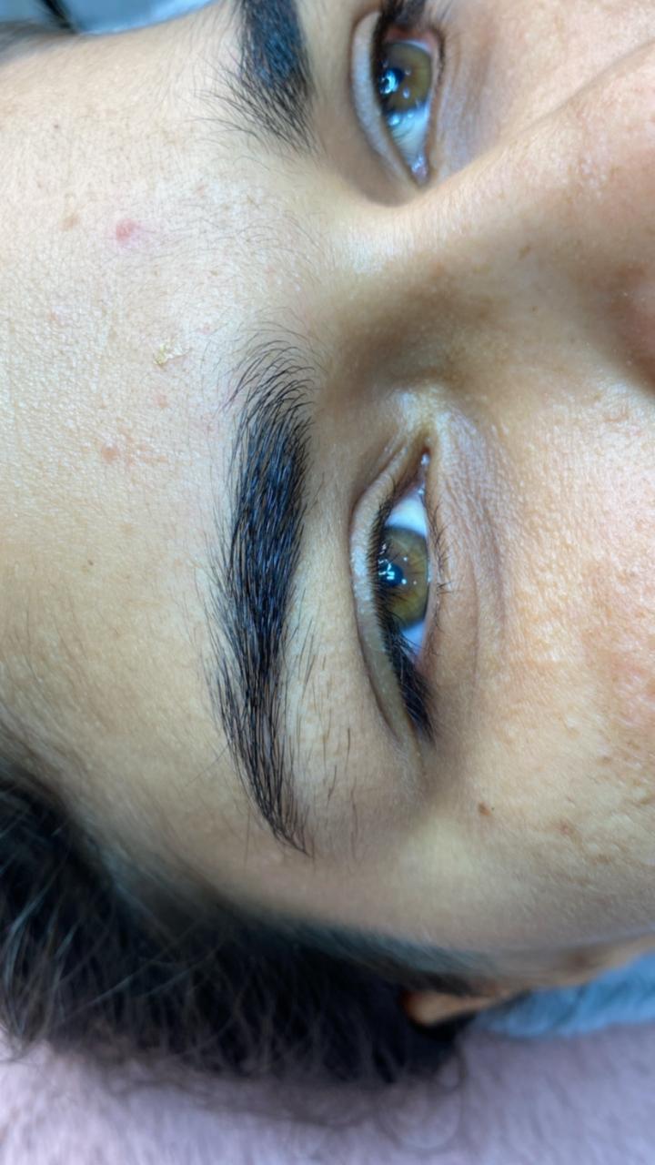 Depilação Facial